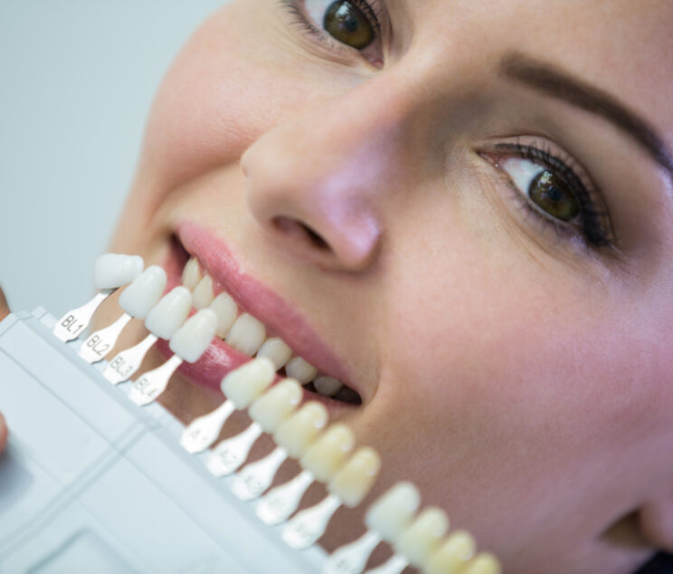 Dentist examining female patient with teeth shades at dental clinic